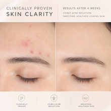 Skin clarity comparison image showing improved skin appearance and smoother texture