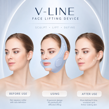 Product dimensions and accessories for the V-line facial lifting device