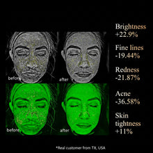 Pro LED face mask comparison chart showing product features